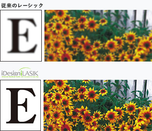 従来の5倍の精度で目を測定!高次収差を矯正可能に