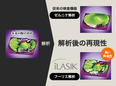 一人ひとりの眼の形状を徹底解析