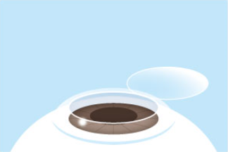 フラップをめくる