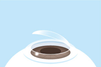 フラップを元の位置に戻す